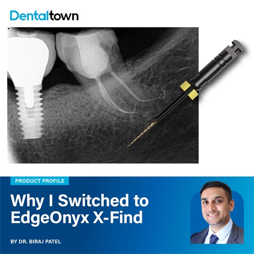 Why I Made the Switch: EdgeOnyx X-Find Dr. Biraj Patel shares why he switched to EdgeOnyx X-Find