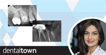 The Cone Beam Conversation Townie endodontist Dr. Sonia Chopra shares the top five reasons she believes it’s well worth a dental professional’s effort to add cone beam technology (and invest the time it takes to learn it).