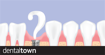 What Is Holding You Back from Placing Implants in Your General Practice?   Townies discuss when and whether placing implants is worth it.