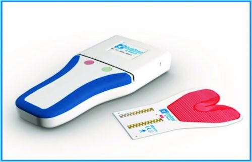 A Review of Digital Occlusal Analysis Technologies