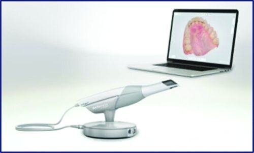 A Review of Digital Occlusal Analysis Technologies