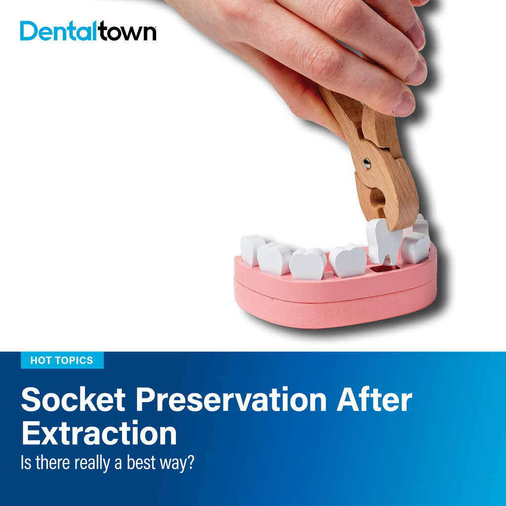 Socket Preservation After Extraction Is there a best material for socket preservation? The evidence suggests success depends less on the product and more on the clinical situation.