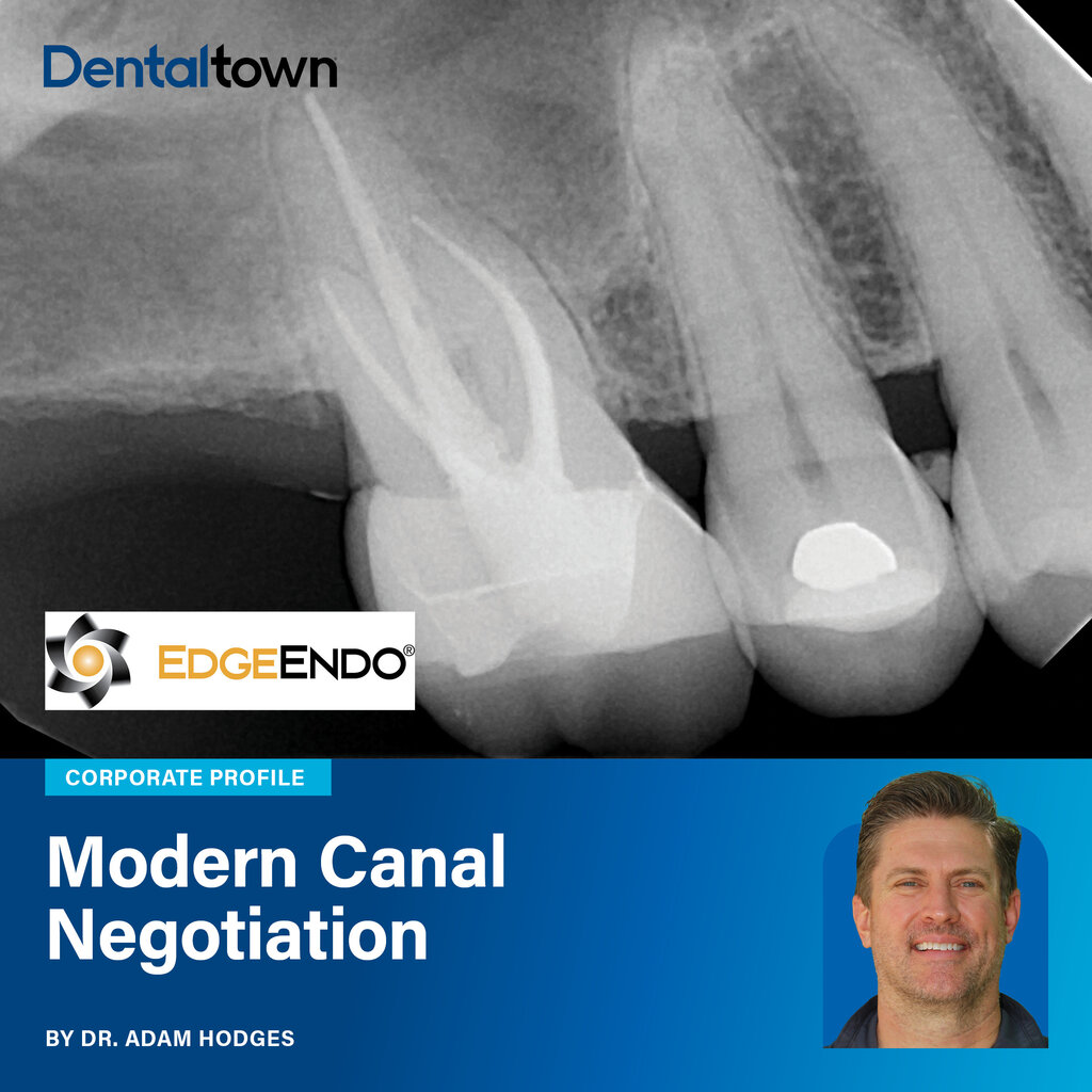Modern Canal Negotiation Dr. Adam Hodges outlines a modern approach to canal negotiation, detailing coronal
enlargement, orifice openers, and heat-treated nickel-titanium instrumentation using
the EdgeOnyx system.
