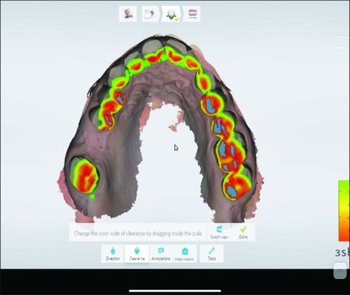 A Review of Digital Occlusal Analysis Technologies