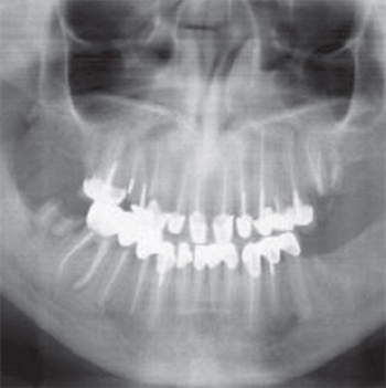 Test Your Reading Comprehension How well can you interpret what’s visible in dental radiographs?
