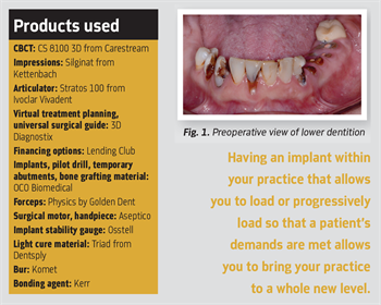 Show Your Work: All in a Day’s Work Dr. Ara Nazarian shares a case he finished in one day where a patient wanted fixed restorations supported by dental implants. 