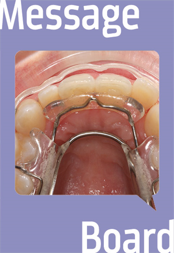 Message Boards: Inman Aligner SuperSlim Case with Bleaching and Edge Bonding Townies talk about inman and invisalign