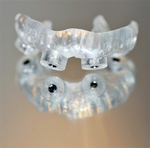 Thinking  Implants Guy Laffan talks about his fascination for implants and shares his dental implant workflow