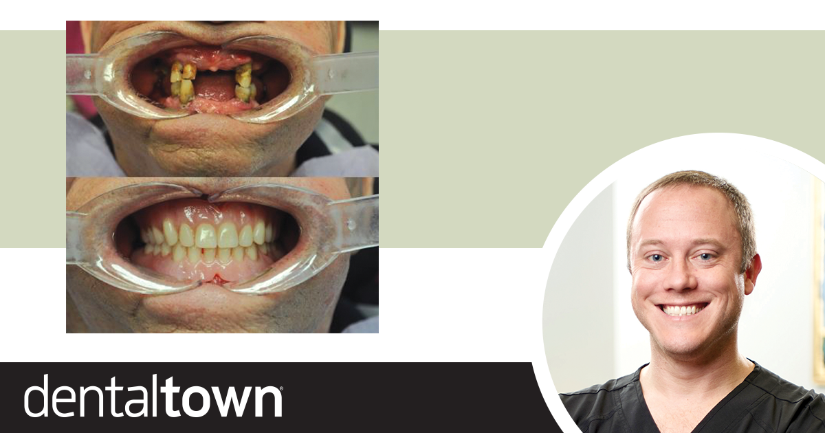 A Dentures Case With A Personal Touch Dr. Ryan McCall shares a denture case that has special meaning to him, because the patient was his grandfather.
