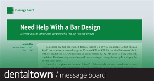 Need Help With a Bar Design 