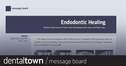 Endodontic Healing Townies share some of their most interesting endo cases and follow-ups.
