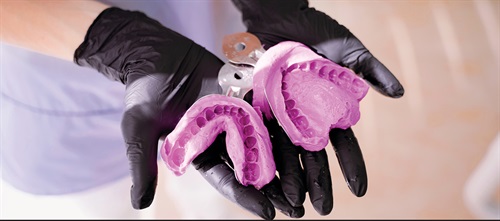 A Great First Impression Indirect restorative dentistry presents dentists with many options in regard to technique, materials and acquisition of a final impression.
Dr. Chad C. Duplantis discusses aspects that help provide predictable results, regardless of the mode of acquisition.