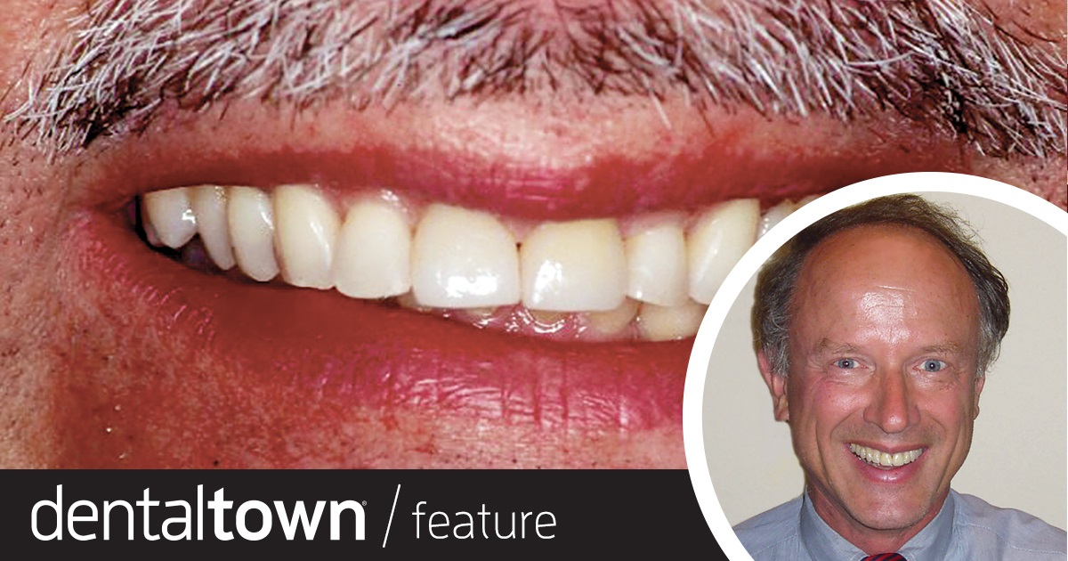 Show Your Work: Minimally Restoring Severe Tooth Surface Loss Dr. Joe Whitehouse shares a case study of a patient whose tooth surface loss was treated using minimally invasive techniques. Instead of removing even more enamel, he started with orthodontics to move the teeth into better position to receive three-quarter wrapped restorations.
