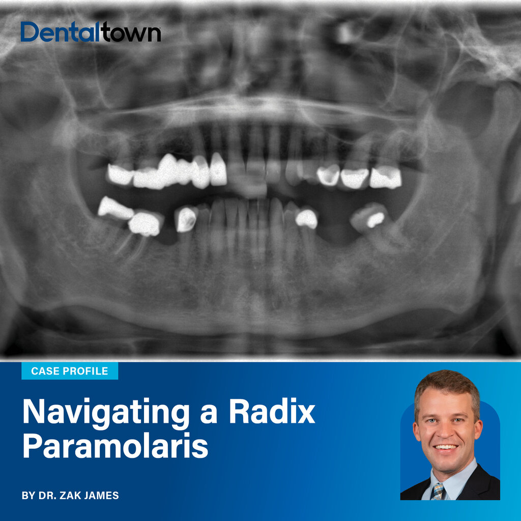 Case Profile: Navigating a Radix Paramolaris