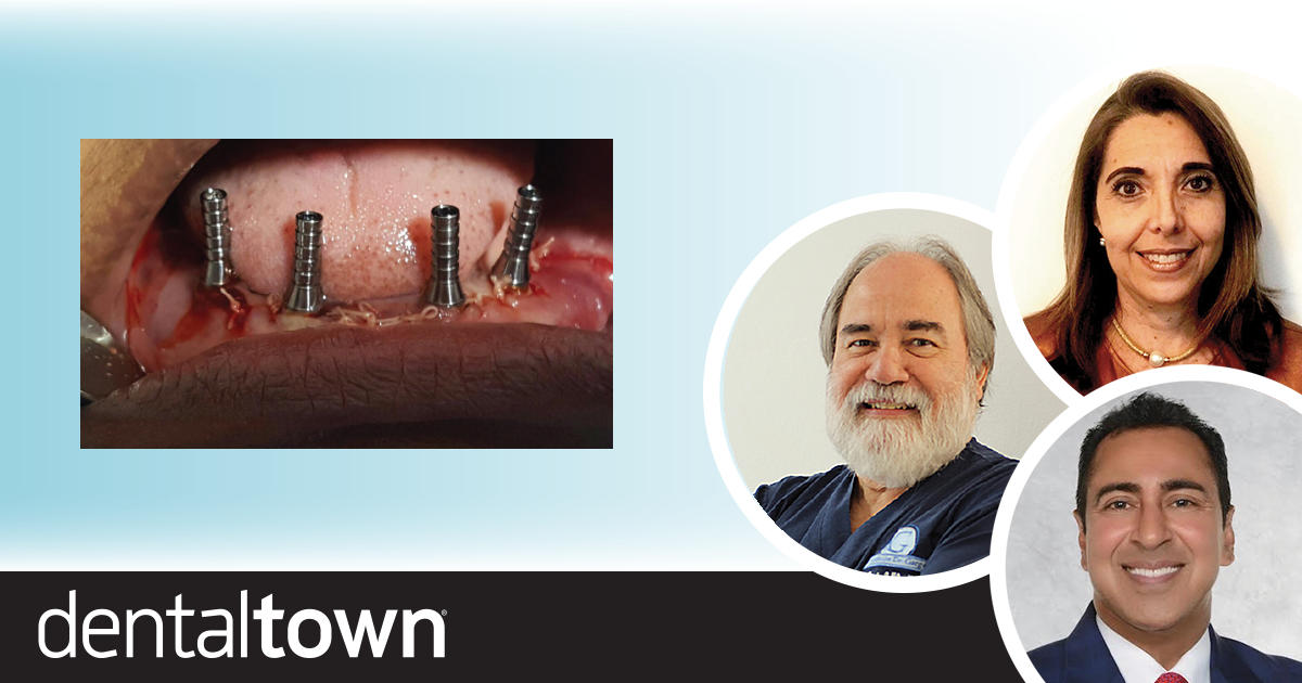 Full-Arch Implant Restoration Dr. Arun K. Garg and colleagues share a full-arch implant restoration case report that demonstrates a relatively simple alternative to traditional dentures or overdentures.