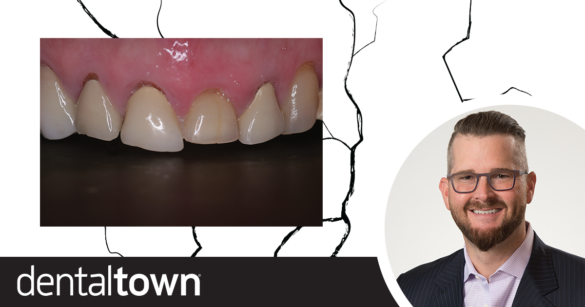 Why Your  Porcelain  is Breaking Dr. Leonard Hess explains the top reasons why porcelain restorations break—and how to prevent it.
