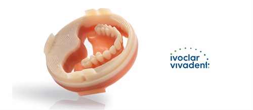 Product Profile: Ivotion Digital Denture System An efficient digital workflow