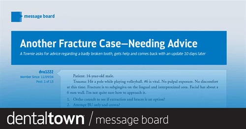 Another Fracture Case—Needing Advice  A Townie asks for advice regarding a badly broken tooth, gets help and comes back with an update 10 days later