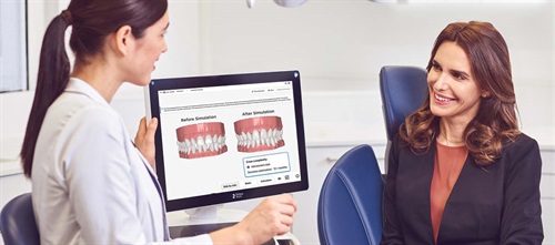 Product Profile: SureSmile Simulator Let the smile do the talking