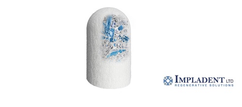 Product Profile: Impladent One-step bone grafting solution for socket preservation