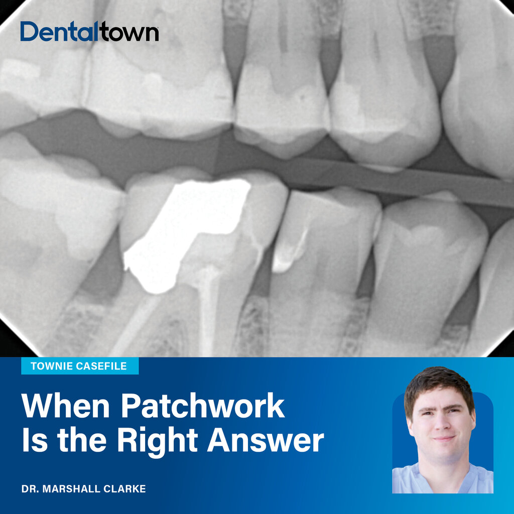 Townie Casefile: When Patchwork Is the Right Answer