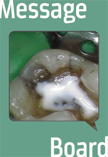 Whose Problems Are We Solving - Ours or the Patient's? An honest discussion about occlusal composites. Is there a new trend that focuses too much attention to aesthetics and not enough on achieving proper occlusion? Where's the balance?