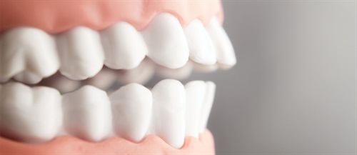 Plan Your Perio Program Developing and maintaining a periodontal care program in a general dental practice requires a few core mindset principles to be shared by the entire team. Dental hygiene coach Rachel Wall, RDH, discusses the most common obstacles to implementing a successful perio program, and how to overcome them.