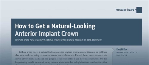 How To Get a Natural-Looking Anterior Implant Crown Townies share how to achieve optimal results when using a titanium or gold abutment