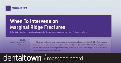 When To Intervene on Marginal Ridge Fractures A doc looks for tips on hunting decay and a Townie steps up with great case photos and advice