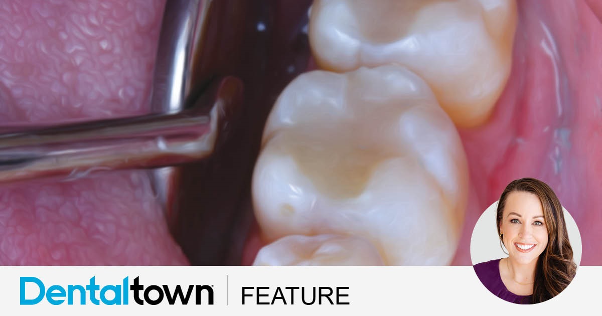 Posterior Protocol