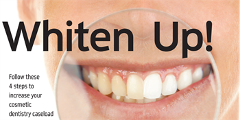 Whiten Up!  Follow these 4 steps to increase your cosmetic dentistry caseload. Dr. Rod Kurthy shares his foolproof method to gaining more cosmetic dentistry patients in your practice.