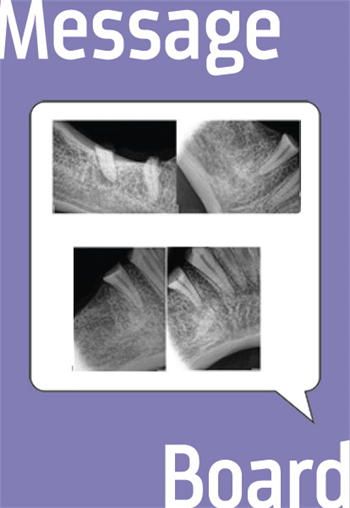 Severe Submandibular Space Infection Post-Extractions  A Townie initiates discussions about the role of postoperative antibiotics in extractions, and the legal implications of their use.