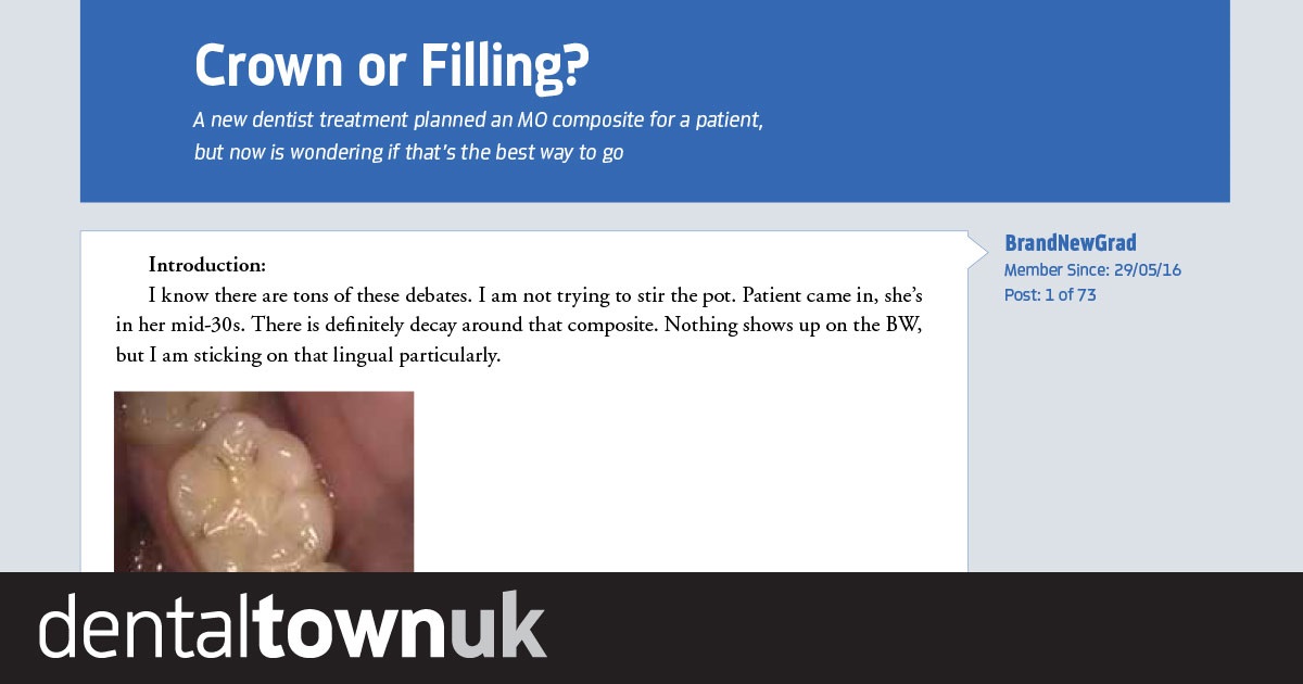 Message Boards: Crown or Filling? A new dentist treatment planned an MO composite for a patient, but now is wondering if that’s the best way to go