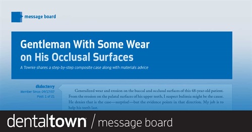 Gentleman With Some Wear on His Occlusal Surfaces A Townie shares a step-by-step composite case along with materials advice