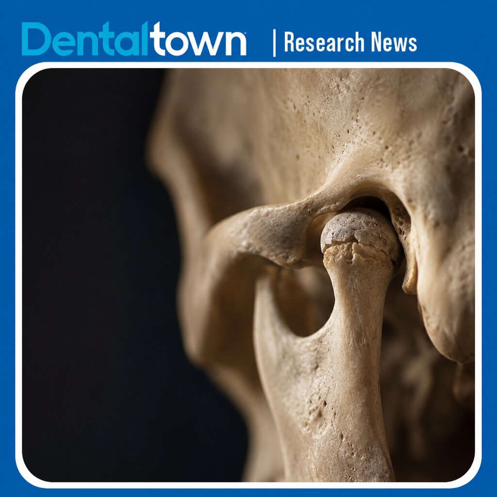 Class II Division 2 Condyles Changed More Than Division 1 After Orthodontics