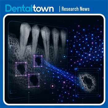 AI Model Shows Promise for Mapping Periodontal Bone Defects on Radiographs