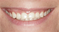 #SmileStories: Creating a Functional Cosmetic Treatment Plan