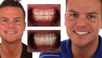 Ignoring the Negative Space: The Sixth Violation of Smile Design