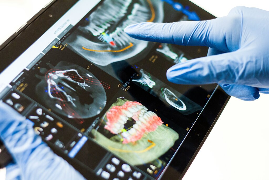 Private Equity In Dentistry: How DSOs Impact Dentists