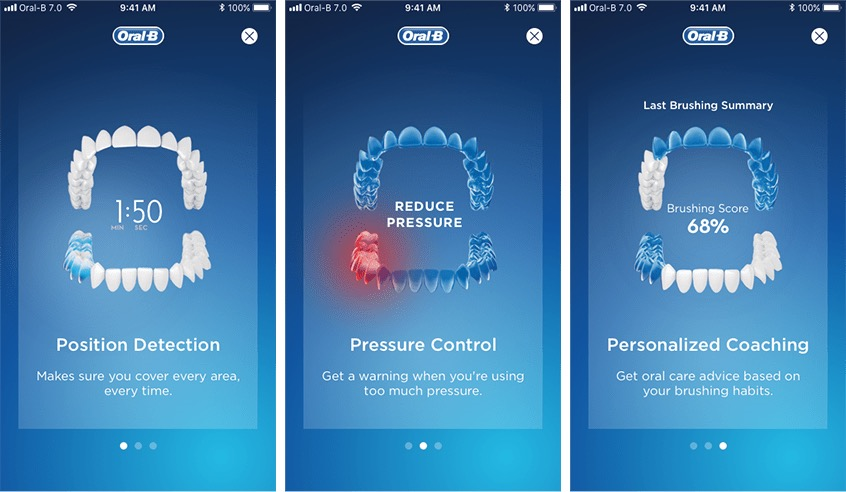 Artificial Intelligence - Meet Toothbrushing