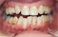 Dentaltown Learning Online..."Crooked to Straight: A General Dentists Journey Using Multiple Technologies" by Dr. Paul Caselle. 