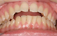  Dentaltown Learning Online....John Nosti .... "Understanding Occlusion". 