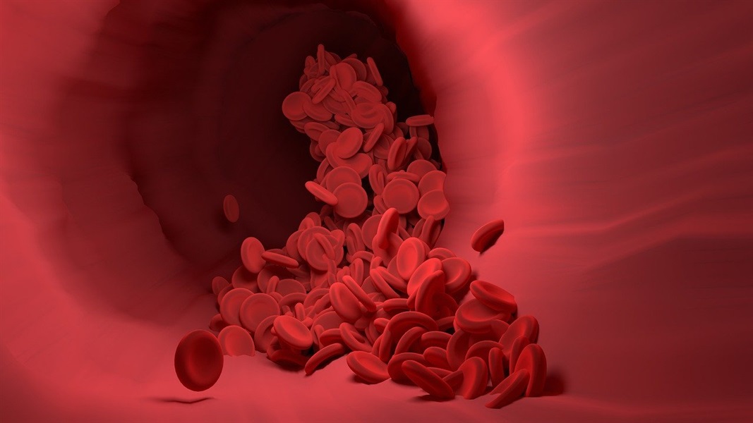 Periodontal Disease Could Be Killing You