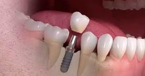 The Dental Assassin