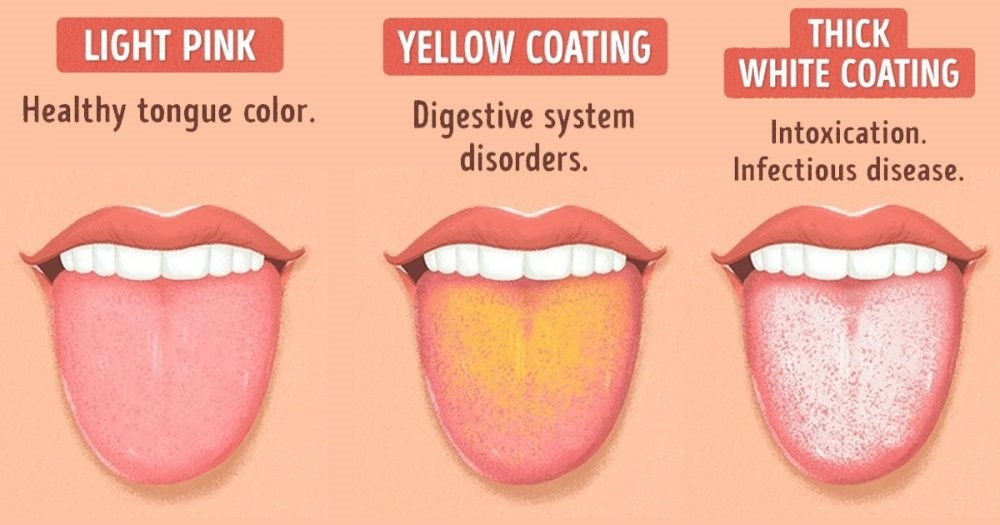 What does it mean when your tongue is…