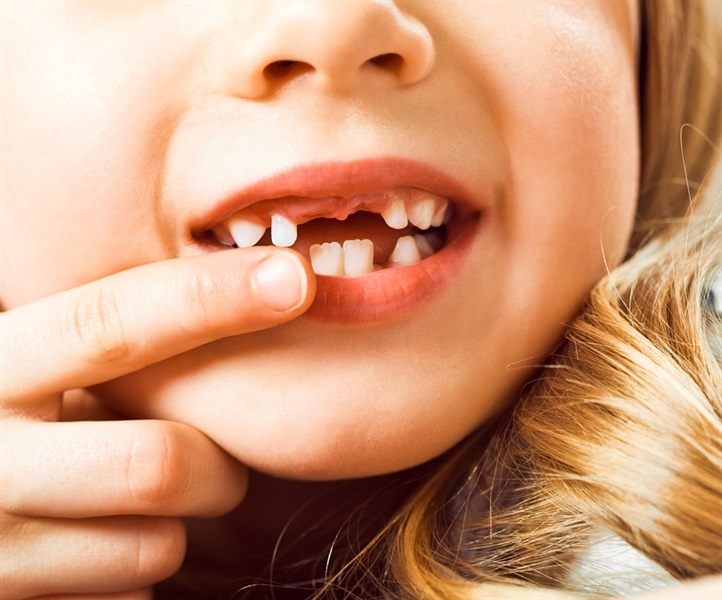 Common Oral Health Problems in Children