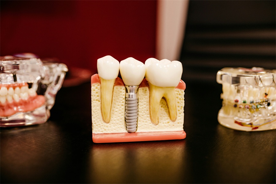 From Consultation to Confidence: The Complete Journey of a Dental Implant Patient