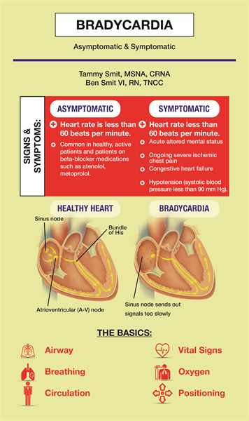 What would you do for bradycardia?