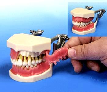 Buyamag Inc Offer Dental Schools Dental Models And Manikins Simulation Phantom Heads. They Help Teachers Explain to Students: Oral Anatomy Diseases Dentistry Techniques. 