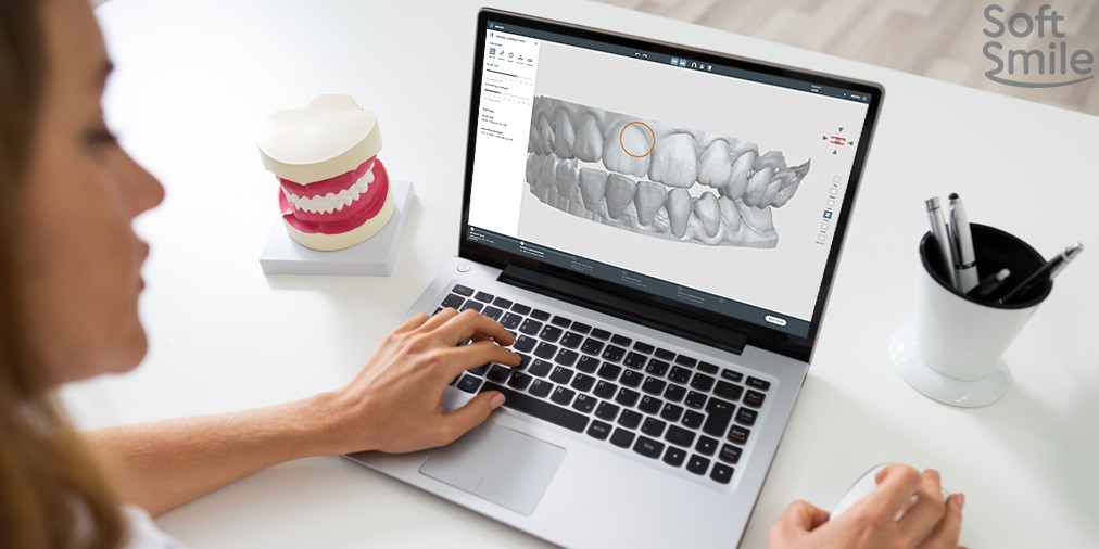 What AI Already Does in Orthodontic Planning, and What It Still Needs From You